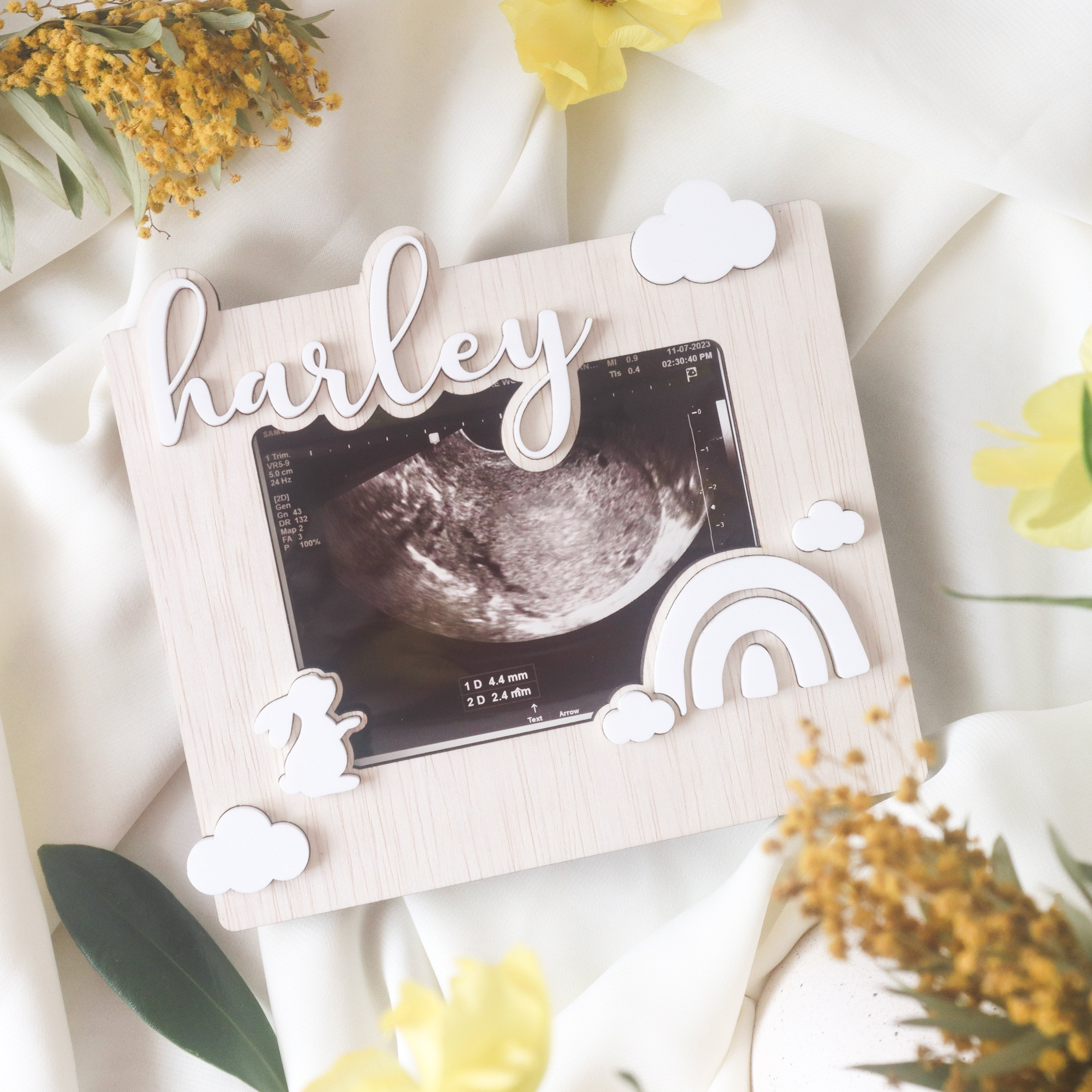 Miscarriage Keepsake Frame Ultrasound Frame The Jomu Co Singapore